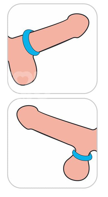 Cockring Ridge Bump Stretcher 25 mm Bleu