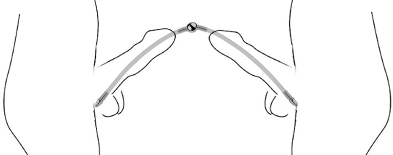 Double Tige d'urètre flexible Flexi Duo 24cm - Diamètre 8mm